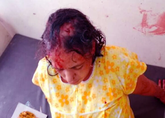 चलती रेलगाड़ी में युवकों ने की महिलाओं से लूटपाट-नर्स का फोड़ा सिर