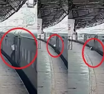 जाने माने सर्जन की जरा सी चूक- बन गई जानलेवा- CCTV में कैद..